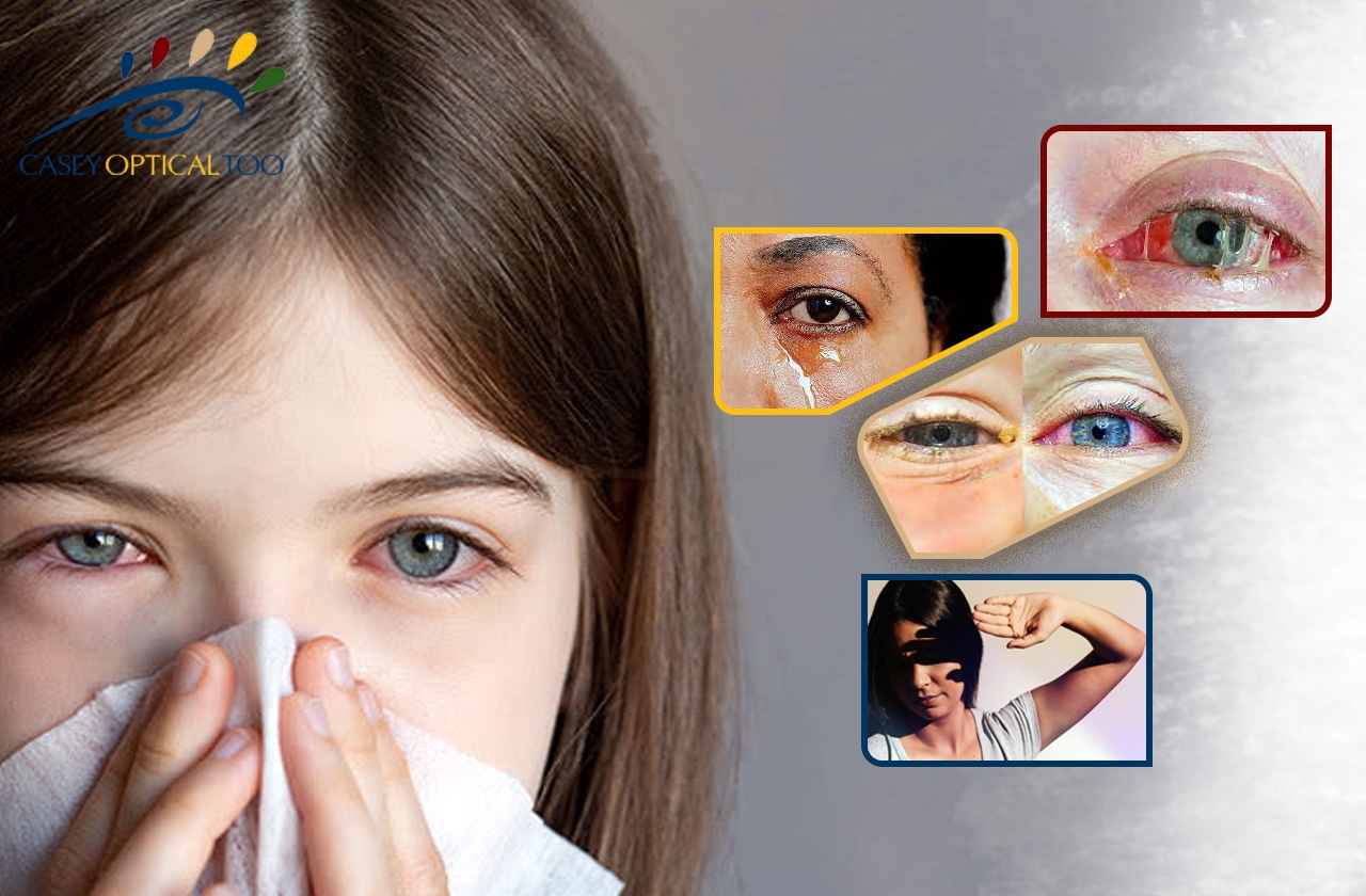 Understanding Eye Colds: Differentiating Between Conjunctivitis and Other Causes
